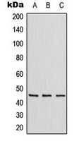 ZNF174 Antibody - Western blot analysis of ZNF174 expression in Jurkat (A); Raw264.7 (B); H9C2 (C) whole cell lysates.
