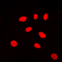 ZNF174 Antibody - Immunofluorescent analysis of ZNF174 staining in Jurkat cells. Formalin-fixed cells were permeabilized with 0.1% Triton X-100 in TBS for 5-10 minutes and blocked with 3% BSA-PBS for 30 minutes at room temperature. Cells were probed with the primary antibody in 3% BSA-PBS and incubated overnight at 4 C in a humidified chamber. Cells were washed with PBST and incubated with a DyLight 594-conjugated secondary antibody (red) in PBS at room temperature in the dark. DAPI was used to stain the cell nuclei (blue).