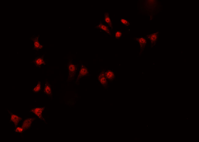 ZNF174 Antibody - Staining HeLa cells by IF/ICC. The samples were fixed with PFA and permeabilized in 0.1% Triton X-100, then blocked in 10% serum for 45 min at 25°C. The primary antibody was diluted at 1:200 and incubated with the sample for 1 hour at 37°C. An Alexa Fluor 594 conjugated goat anti-rabbit IgG (H+L) Ab, diluted at 1/600, was used as the secondary antibody.