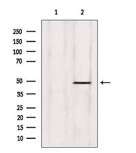 ZNF174 Antibody - Western blot analysis of extracts of rat heart tissue using ZNF174 antibody. Lane 1 was treated with the blocking peptide.