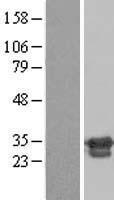 ZNF174 Protein - Western validation with an anti-DDK antibody * L: Control HEK293 lysate R: Over-expression lysate