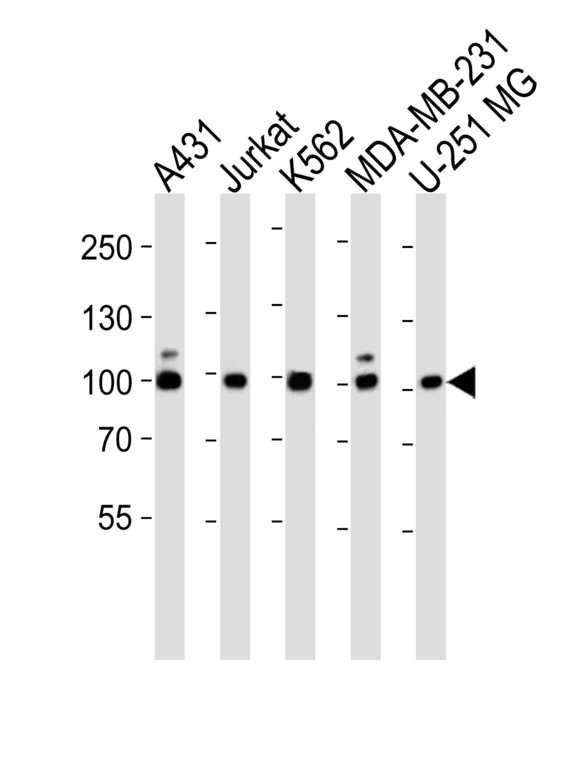 ZNF175 Antibody - Western blot of lysates from A431, Jurkat, K562, MDA-MB-231, U-251 MG cell line (from left to right) with ZNF175 Antibody. Antibody was diluted at 1:1000 at each lane. A goat anti-rabbit IgG H&L (HRP) at 1:5000 dilution was used as the secondary antibody. Lysates at 35 ug per lane.