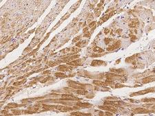 ZNF175 Antibody - Immunochemical staining of ZNF175 in cynomolgus heart with rabbit polyclonal antibody at 1:100 dilution, formalin-fixed paraffin embedded sections.