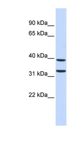 ZNF177 / PIGX Antibody - ZNF177 antibody Western blot of Fetal Pancreas lysate. This image was taken for the unconjugated form of this product. Other forms have not been tested.