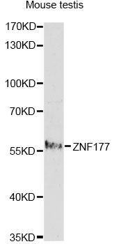 ZNF177 / PIGX Antibody - Western blot analysis of extracts of mouse testis, using ZNF177 antibody at 1:1000 dilution. The secondary antibody used was an HRP Goat Anti-Rabbit IgG (H+L) at 1:10000 dilution. Lysates were loaded 25ug per lane and 3% nonfat dry milk in TBST was used for blocking. An ECL Kit was used for detection and the exposure time was 2.5min.
