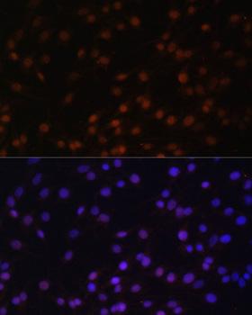 ZNF177 / PIGX Antibody - Immunofluorescence analysis of C6 cells using ZNF177 Polyclonal Antibody at dilution of 1:100.Blue: DAPI for nuclear staining.