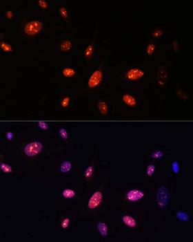 ZNF177 / PIGX Antibody - Immunofluorescence analysis of U-2OS cells using ZNF177 Polyclonal Antibody at dilution of 1:100.Blue: DAPI for nuclear staining.