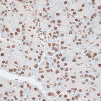 ZNF177 / PIGX Antibody - Immunohistochemistry of paraffin-embedded Rat pancreas using ZNF177 Polyclonal Antibody at dilution of 1:100 (40x lens).