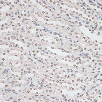 ZNF177 / PIGX Antibody - Immunohistochemistry of paraffin-embedded Mouse kidney using ZNF177 Polyclonal Antibody at dilution of 1:100 (40x lens).