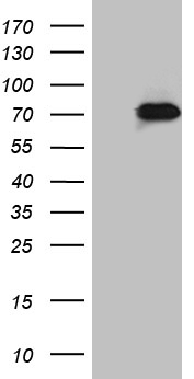 ZNF18 Antibody - HEK293T cells were transfected with the pCMV6-ENTRY control. (Left lane) or pCMV6-ENTRY ZNF18. (Right lane) cDNA for 48 hrs and lysed