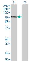 ZNF18 Antibody - Western Blot analysis of ZNF18 expression in transfected 293T cell line by ZNF18 monoclonal antibody (M01), clone 2A4.Lane 1: ZNF18 transfected lysate(62.3 KDa).Lane 2: Non-transfected lysate.