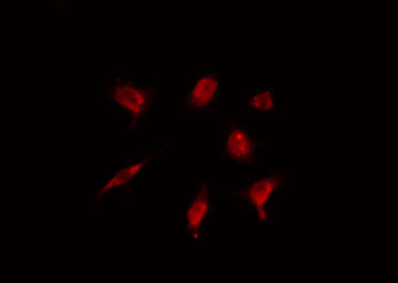 ZNF18 Antibody - Staining HeLa cells by IF/ICC. The samples were fixed with PFA and permeabilized in 0.1% Triton X-100, then blocked in 10% serum for 45 min at 25°C. The primary antibody was diluted at 1:200 and incubated with the sample for 1 hour at 37°C. An Alexa Fluor 594 conjugated goat anti-rabbit IgG (H+L) antibody, diluted at 1/600, was used as secondary antibody.