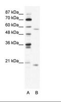 ZNF18 Antibody - A: Marker, B: HepG2 Cell Lysate.  This image was taken for the unconjugated form of this product. Other forms have not been tested.