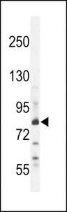 ZNF180 Antibody - ZN180 Antibody western blot of WiDr cell line lysates (35 ug/lane). The ZN180 antibody detected the ZN180 protein (arrow).