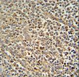 ZNF180 Antibody - ZN180 antibody immunohistochemistry of formalin-fixed and paraffin-embedded human spleen tissue followed by peroxidase-conjugated secondary antibody and DAB staining.
