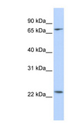 ZNF185 Antibody - ZNF185 antibody Western blot of HeLa lysate. This image was taken for the unconjugated form of this product. Other forms have not been tested.