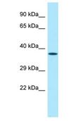 ZNF185 Antibody - ZNF185 antibody Western Blot of Mouse Stomach. Antibody dilution: 1 ug/ml.  This image was taken for the unconjugated form of this product. Other forms have not been tested.