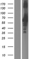 ZNF185 Protein - Western validation with an anti-DDK antibody * L: Control HEK293 lysate R: Over-expression lysate