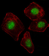 ZNF187 Antibody - Fluorescent image of A549 cell stained with ZNF187 Antibody. A549 cells were fixed with 4% PFA (20 min), permeabilized with Triton X-100 (0.1%, 10 min), then incubated with ZNF187 primary antibody (1:25, 1 h at 37°C). For secondary antibody, Alexa Fluor 488 conjugated donkey anti-rabbit antibody (green) was used (1:400, 50 min at 37°C). Cytoplasmic actin was counterstained with Alexa Fluor 555 (red) conjugated Phalloidin (7units/ml, 1 h at 37°C). ZNF187 immunoreactivity is localized to Nucleus significantly.