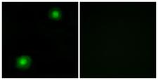 ZNF187 Antibody - Immunofluorescence analysis of A549 cells, using ZNF187 Antibody. The picture on the right is blocked with the synthesized peptide.