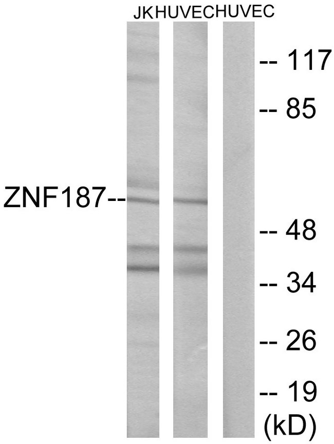 ZNF187 Antibody - Western blot analysis of lysates from Jurkat and HUVEC cells, using ZNF187 Antibody. The lane on the right is blocked with the synthesized peptide.