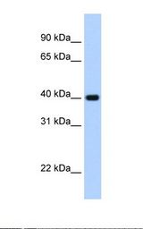 ZNF187 Antibody - Transfected 293T cell lysate. Antibody concentration: 2.5 ug/ml. Gel concentration: 15%.  This image was taken for the unconjugated form of this product. Other forms have not been tested.