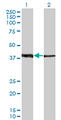 ZNF187 Antibody - Western Blot analysis of ZNF187 expression in transfected 293T cell line by ZNF187 monoclonal antibody (M01A), clone 1D9.Lane 1: ZNF187 transfected lysate(37.5 KDa).Lane 2: Non-transfected lysate.