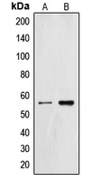 ZNF187 Antibody - Western blot analysis of ZNF187 expression in HL60 (A); SP2/0 (B) whole cell lysates.