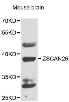 ZNF187 Antibody - Western blot analysis of extracts of mouse brain.