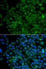 ZNF187 Antibody - Immunofluorescence analysis of A549 cells.