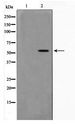 ZNF187 Antibody - Western blot of Jurkat cell lysate using ZNF187 Antibody