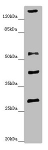ZNF187 Antibody - Western blot All Lanes: ZSCAN26antibody at 1.34ug/ml+ Mouse brain tissue Goat polyclonal to rabbit at 1/10000 dilution Predicted band size: 56,38 kDa Observed band size: 55,29,40,160 kDa