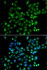 ZNF187 Antibody - Immunofluorescence analysis of A549 cells using ZSCAN26 Polyclonal Antibody.