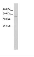 ZNF19 Antibody - Jurkat Cell Lysate.  This image was taken for the unconjugated form of this product. Other forms have not been tested.