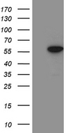 ZNF19 Antibody - HEK293T cells were transfected with the pCMV6-ENTRY control. (Left lane) or pCMV6-ENTRY ZNF19. (Right lane) cDNA for 48 hrs and lysed. Equivalent amounts of cell lysates. (5 ug per lane) were separated by SDS-PAGE and immunoblotted with anti-ZNF19. (1:2000)