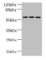 ZNF19 Antibody - Western blot All lanes: ZNF19 antibody at 4µg/ml Lane 1: Mouse liver tissue Lane 2: MDA-MB-231 whole cell lysate Lane 3: HepG2 whole cell lysate Secondary Goat polyclonal to rabbit IgG at 1/10000 dilution Predicted band size: 53, 52 kDa Observed band size: 53 kDa