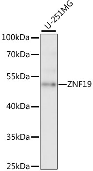 ZNF19 Antibody - Western blot analysis of extracts of U-251MG cells, using ZNF19 antibody at 1:1000 dilution. The secondary antibody used was an HRP Goat Anti-Rabbit IgG (H+L) at 1:10000 dilution. Lysates were loaded 25ug per lane and 3% nonfat dry milk in TBST was used for blocking. An ECL Kit was used for detection and the exposure time was 5s.