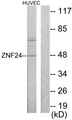 ZNF191 / ZNF24 Antibody - Western blot analysis of lysates from HUVEC cells, using ZNF24 Antibody. The lane on the right is blocked with the synthesized peptide.