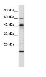 ZNF191 / ZNF24 Antibody - Jurkat Cell Lysate.  This image was taken for the unconjugated form of this product. Other forms have not been tested.