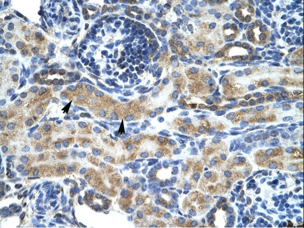 ZNF191 / ZNF24 Antibody - ZNF24 antibody ARP33519_P050-NP_008896-ZNF24 (zinc finger protein 24) Antibody was used in IHC to stain formalin-fixed, paraffin-embedded human kidney.  This image was taken for the unconjugated form of this product. Other forms have not been tested.