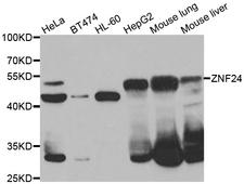 ZNF191 / ZNF24 Antibody - Western blot analysis of extracts of various cell lines.