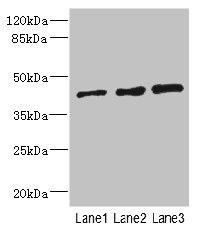 ZNF191 / ZNF24 Antibody - Western blot All Lanes: ZNF24 antibody at 2.88ug/ml Lane 1: 293T whole cell lysate Lane 2: Jurkat whole cell lysate Lane 3: Hela whole cell lysate Goat polyclonal to Rabbit IgG at 1/10000 dilution Predicted band size: 43,23 kDa Observed band size: 42 kDa