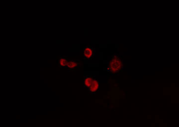 ZNF191 / ZNF24 Antibody - Staining HuvEc cells by IF/ICC. The samples were fixed with PFA and permeabilized in 0.1% Triton X-100, then blocked in 10% serum for 45 min at 25°C. The primary antibody was diluted at 1:200 and incubated with the sample for 1 hour at 37°C. An Alexa Fluor 594 conjugated goat anti-rabbit IgG (H+L) antibody, diluted at 1/600, was used as secondary antibody.