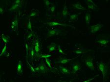 ZNF191 / ZNF24 Antibody - Immunofluorescence staining of ZNF24 in U251MG cells. Cells were fixed with 4% PFA, permeabilzed with 0.1% Triton X-100 in PBS, blocked with 10% serum, and incubated with rabbit anti-Human ZNF24 polyclonal antibody (dilution ratio 1:200) at 4°C overnight. Then cells were stained with the Alexa Fluor 488-conjugated Goat Anti-rabbit IgG secondary antibody (green). Positive staining was localized to Nucleus.