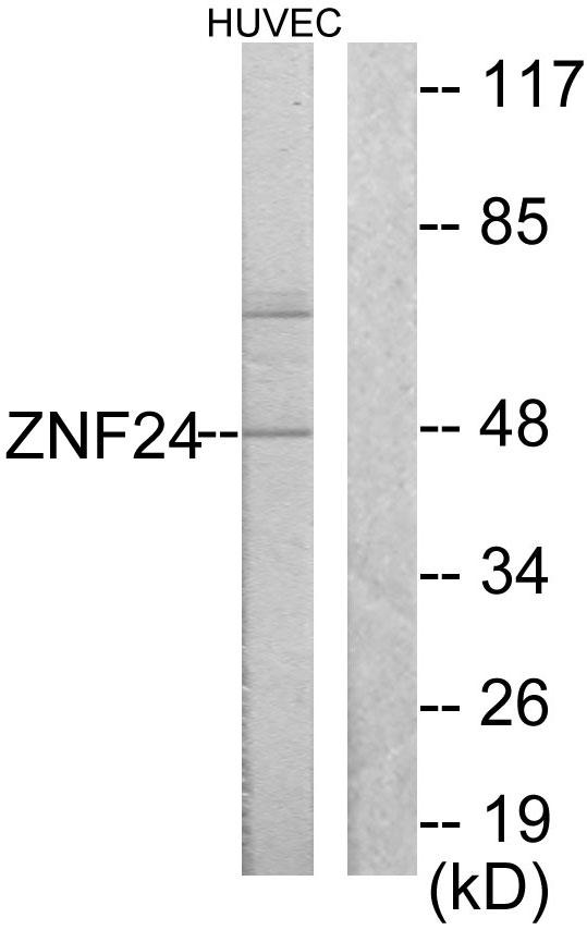 ZNF191 / ZNF24 Antibody - Western blot analysis of extracts from HUVEC cells, using ZNF24 antibody.