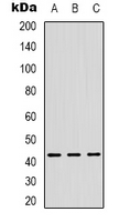 ZNF191 / ZNF24 Antibody - Western blot analysis of ZNF24 expression in HeLa (A); Jurkat (B); HUVEC (C) whole cell lysates.