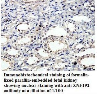 ZNF192 Antibody