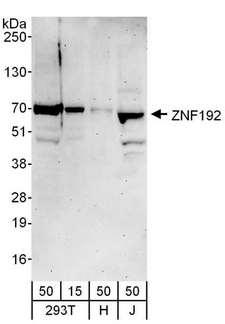 ZNF192 Antibody - Detection of Human ZNF192 by Western Blot. Samples: Whole cell lysate from 293T (T; 50 ug), HeLa (H; 50 ug) and Jurkat (J; 50 ug) cells. Antibodies: Affinity purified rabbit anti-ZNF192 antibody used for WB at 1 ug/ml. Detection: Chemiluminescence with an exposure time of 3 minutes.