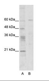 ZNF192 Antibody - A: Marker, B: HepG2 Cell Lysate.  This image was taken for the unconjugated form of this product. Other forms have not been tested.