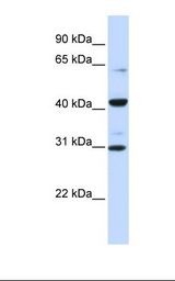 ZNF193 Antibody - Fetal brain lysate. Antibody concentration: 1.0 ug/ml. Gel concentration: 12%.  This image was taken for the unconjugated form of this product. Other forms have not been tested.